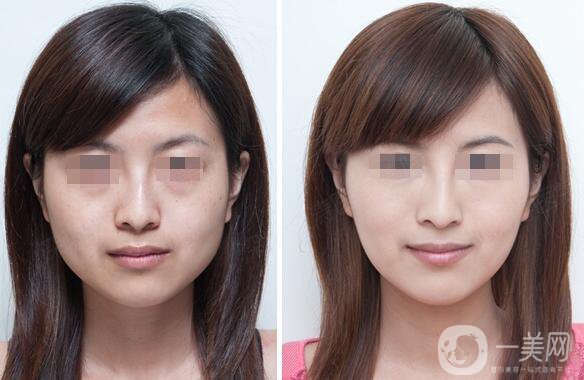 *大概要多少錢、*的費用詳解