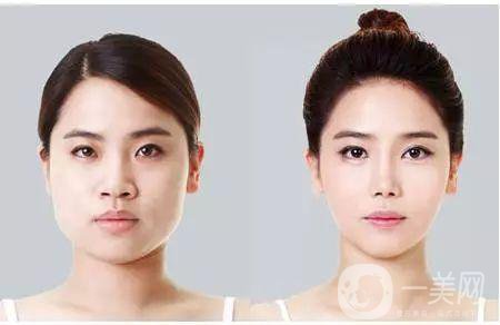 注射*大概需要多少錢？