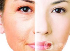 光子嫩膚的果如何、光子嫩膚到底怎么樣？