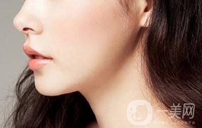 墊下巴后怎么護(hù)理?墊下巴注意事項介紹