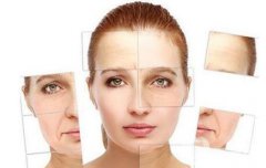 祛皺多少錢 去皺價格一般是多少