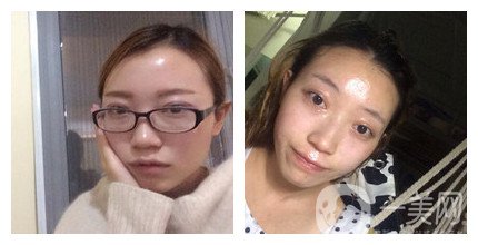 上海九院整形好嗎 上海九院各大整形案例詳解_坐診專家