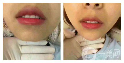 上海九院整形好嗎 上海九院各大整形案例詳解_坐診專家