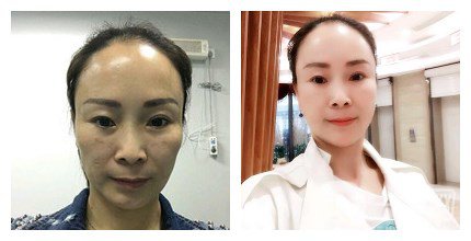 上海九院整形好嗎 上海九院各大整形案例詳解_坐診專家