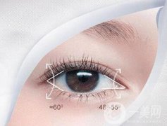 開眼角手術(shù)的價格 開眼角多少錢