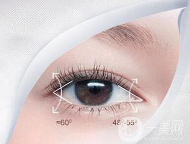 開眼角手術(shù),價格