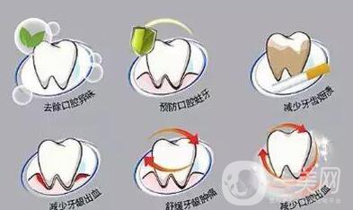 潔牙多少錢？成都潔牙價(jià)格貴嗎？