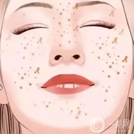 如何去除妊娠斑比較*果？