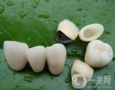 做完烤瓷牙可以使用多少年？