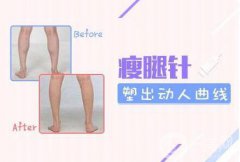 注射瘦臉的價格 注射瘦臉一般需要多少錢