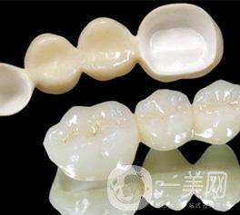 做普通烤瓷牙一般需要多少錢？