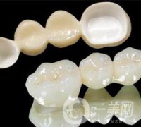 美容冠多少錢 價格詳情介紹