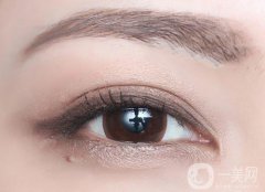 什么是高分子雙眼皮 價格多少錢？