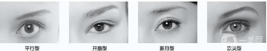 什么是高分子雙眼皮 價格多少錢？