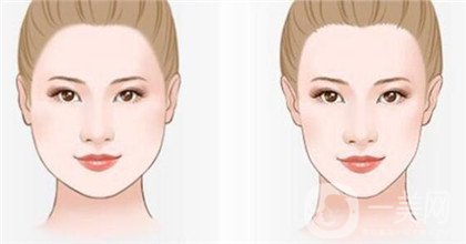 *一針要多少錢(qián) 正規(guī)醫(yī)院*價(jià)格貴嗎