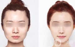 *價格多少？詳解*具體費用