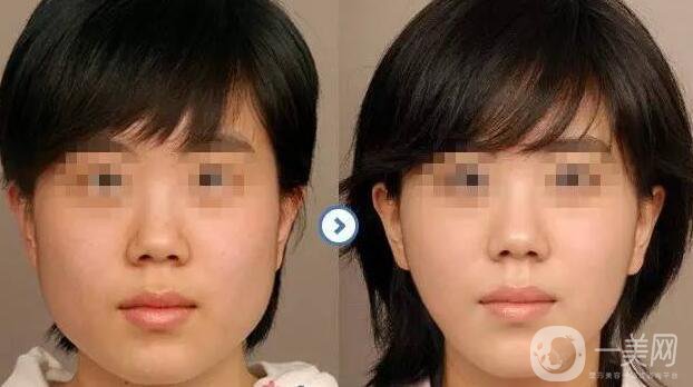 *價(jià)格多少？詳解*具體費(fèi)用