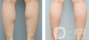 **果嗎、*有副作用嗎