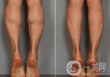 **果嗎、*有副作用嗎