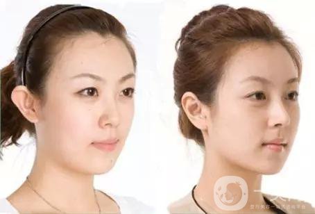 做完*手術(shù)7天能恢復(fù)嗎？