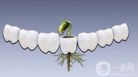 做一次種植牙的價(jià)格 費(fèi)用貴嗎？