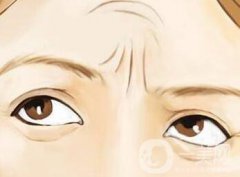 去皺的方法 怎么去皺