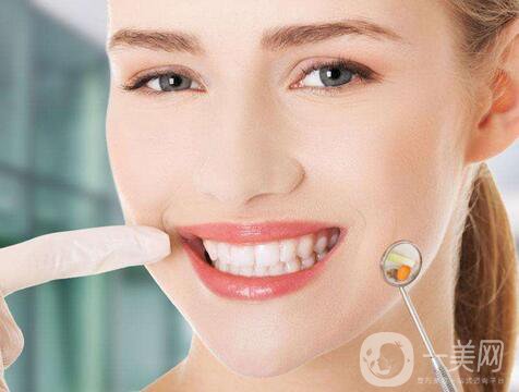 烤瓷牙多少錢 烤瓷牙價(jià)格是多少