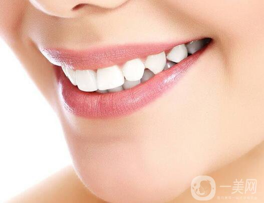 烤瓷牙多少錢 烤瓷牙價(jià)格是多少