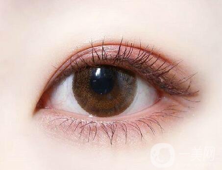 割雙眼皮好醫(yī)院有哪些