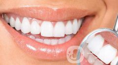 烤瓷牙能用多長時間？烤瓷牙的壽命有多長