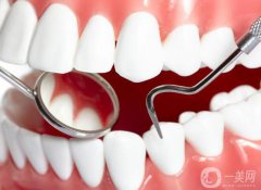 烤瓷牙種類及價格 烤瓷牙果圖