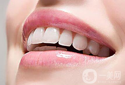 烤瓷牙種類及價格 烤瓷牙*果圖