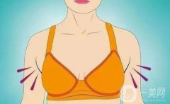 副乳吸脂多久消腫 副乳吸脂消腫時間