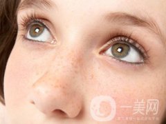 黃褐斑怎么形成的 怎么去除？