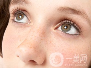 黃褐斑怎么形成的 怎么去除？