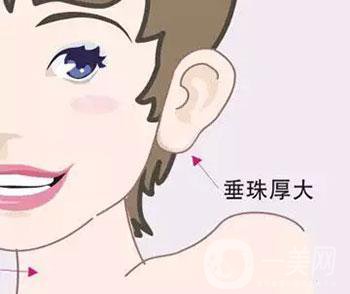 注射玻尿酸豐耳垂*果怎么樣？
