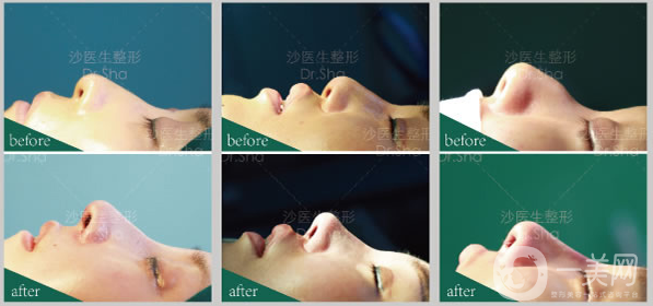 大連沙醫(yī)生新美鼻藝術(shù)節(jié)，帶你“預(yù)見·未來美”