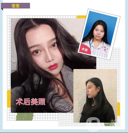 大連沙醫(yī)生新美鼻藝術(shù)節(jié)，帶你“預(yù)見·未來美”