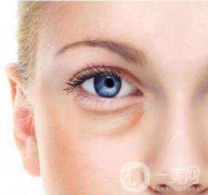 內(nèi)切去眼袋恢復(fù)過程大揭秘