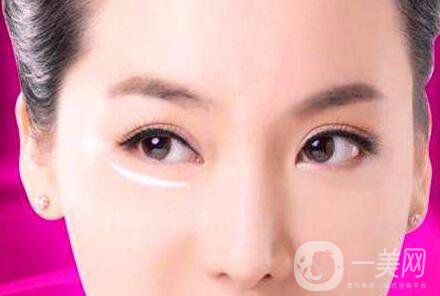 內(nèi)切去眼袋恢復過程大揭秘