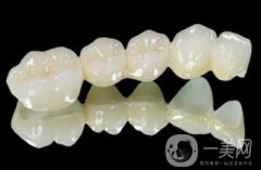 一個(gè)烤瓷牙多少錢 價(jià)格貴嗎？