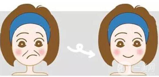 瑞蘭,注射除皺,多少錢