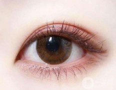 雙眼皮做失敗怎么修復(fù) 雙眼皮失敗修復(fù)