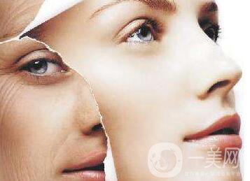 拉皮手術(shù),拉皮