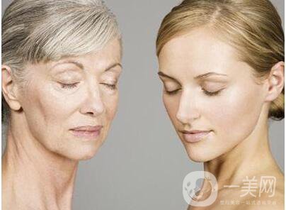 拉皮手術(shù),拉皮