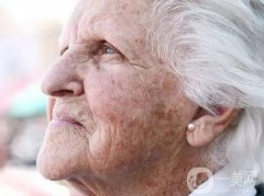 老年斑怎么調(diào)節(jié) 激光去老年斑怎么樣