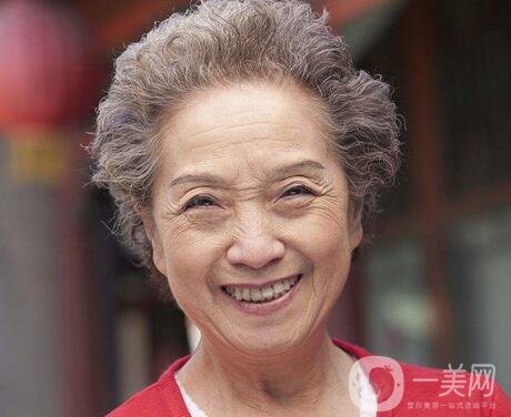 長(zhǎng)老年斑怎么辦 老年斑怎么去除