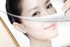 去黃褐斑的價格 要多少錢