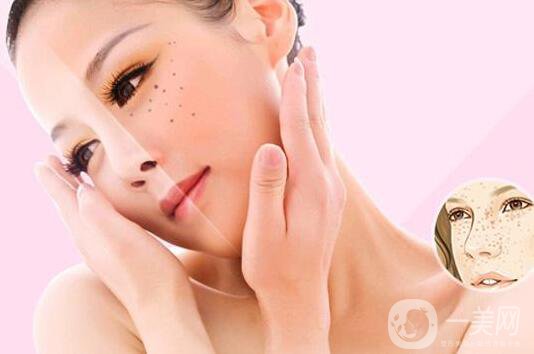 醫(yī)院祛斑價(jià)格 醫(yī)院祛斑要多少錢