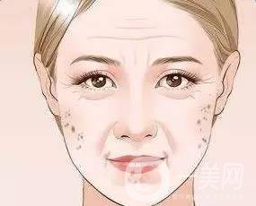 為什么會(huì)長(zhǎng)老年斑，和哪些因素有關(guān)？